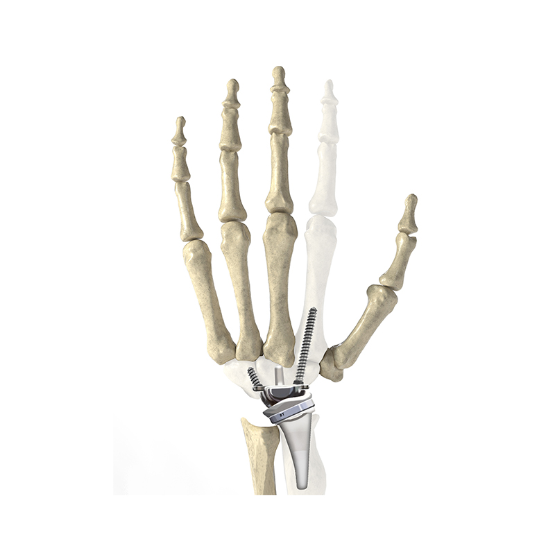 Sports Medicine