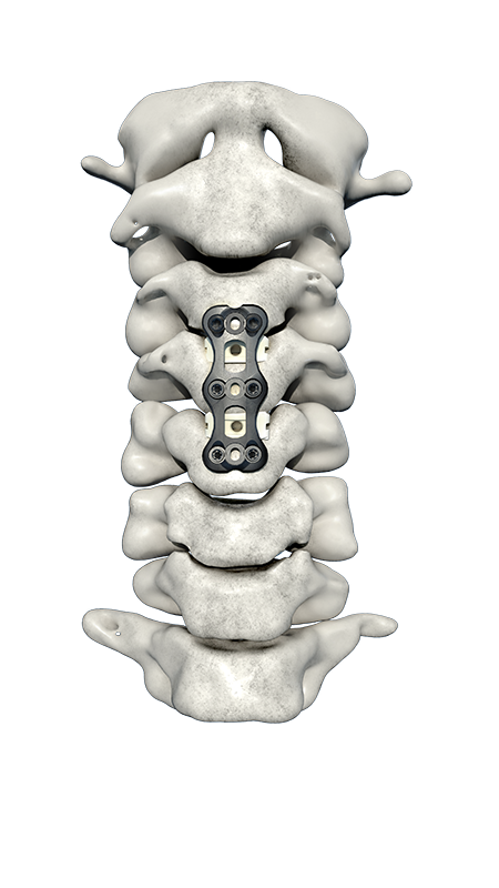 Cervical System
