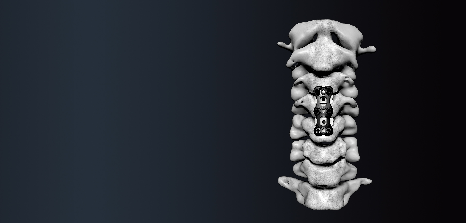 Anterior Cervical Plate System